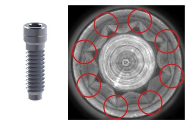Tiny dental screw